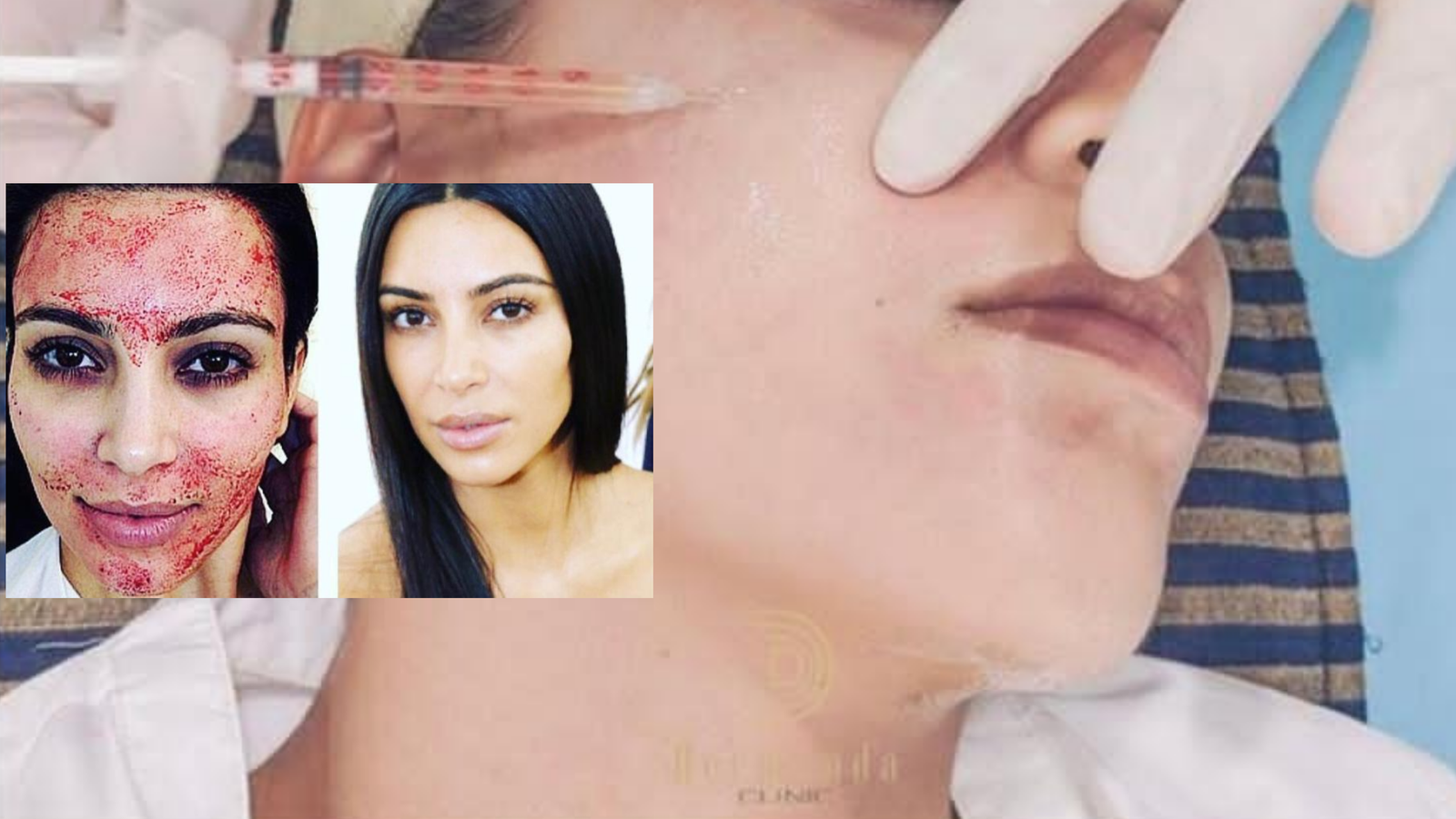 صورة مميزة: ‏ Dermand Clinic تقدم تقنية الـPRP بجودة عالية واهتمامٍ لا مثيل له