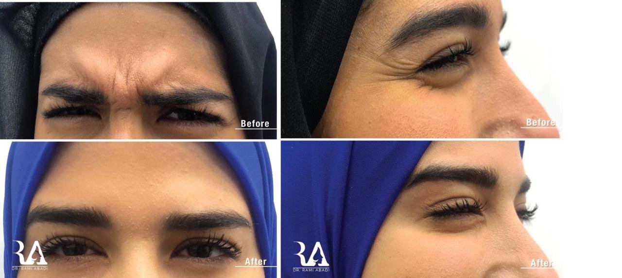 صورة مميزة: حوار مع دكتور الأمراض الجلديَّة والتّجميل رامي عبادي