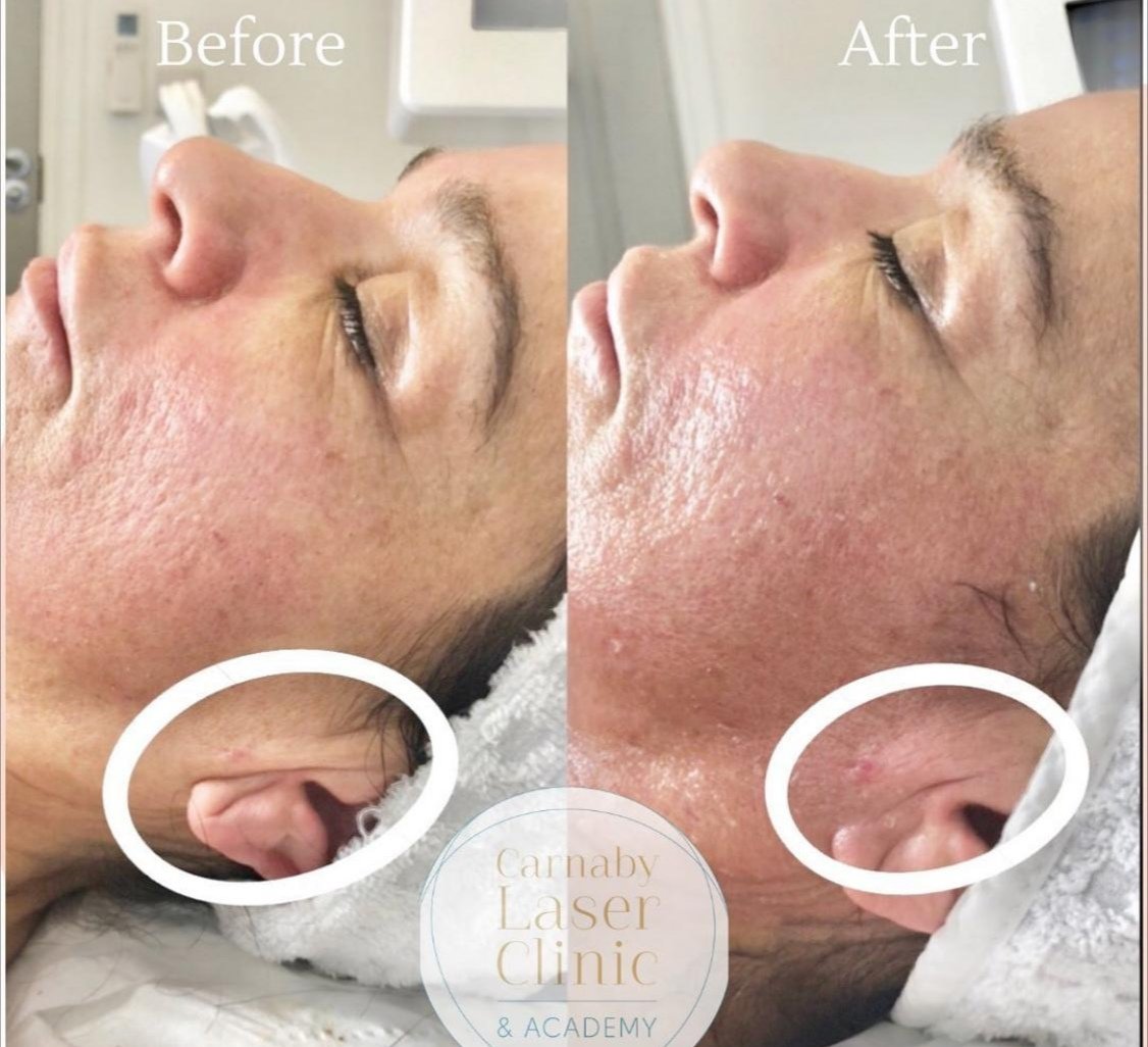 صورة مميزة: العيادة الطبية التجميلية The Carnaby Laser Clinic تُكَرَّم من قِبل IMAGE SKINCARE لمرات متتالية
