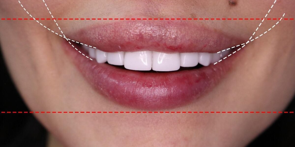 الدكتور Habib Zarifeh يبتكر تقنية جديدة لمحاربة الشيخوخة و تجميل الأسنان Smile Lift - صورة مميزة الدكتور Habib Zarifeh يبتكر تقنية جديدة لمحاربة الشيخوخة و تجميل الأسنان Smile Lift