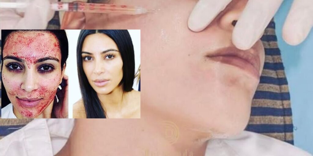 Dermand Clinic تقدم تقنية الـPRP بجودة عالية واهتمامٍ لا مثيل له