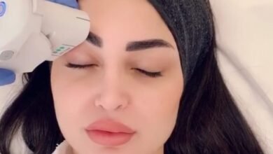 تعرفي على تقنية Ultherapy مع الدكتور رامي عبادي