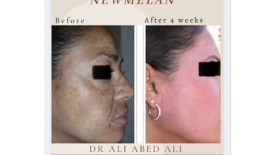 دكتور التجميل ali abedali يتحدث عن تقنية newmelan pigmentation